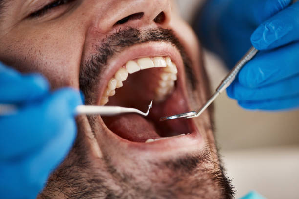 Best Weekend Emergency Dentist in West Branch, IA