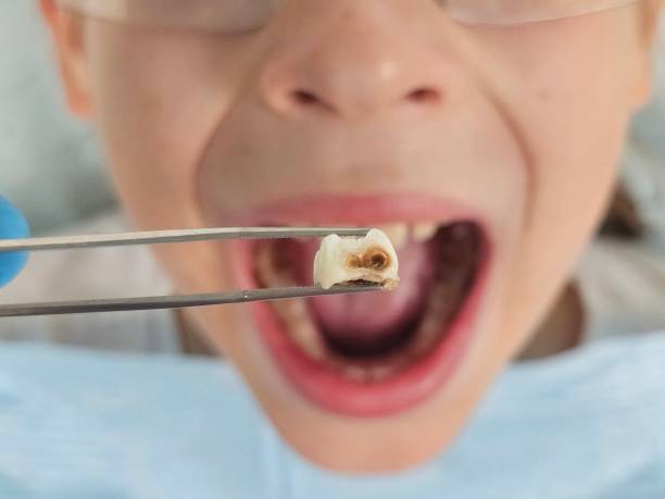 Best Emergency Dentist for Special Needs Patients in West Branch, IA