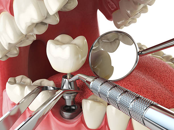 Best Emergency Dental Extractions in West Branch, IA